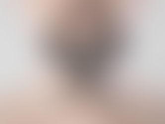 Beard Hair Transplant: Mastering the Art with ASAHRS Fellowship