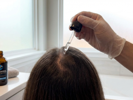 Does Minoxidil Work for Women: Insights from ASAHRS Fellowship