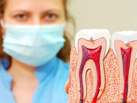 Managing Post-Root Canal Pain: Dubai Dentists' Recommendations
