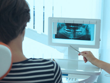 Dental Implants Cost Can Differ From One State to the Other