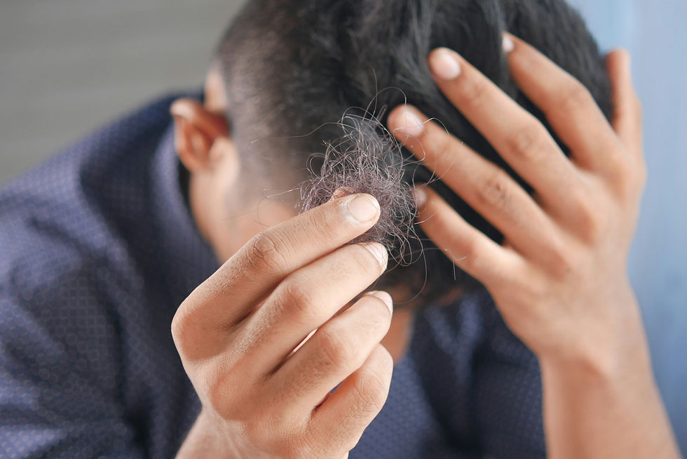 Dandruff Treatment in Al Ain