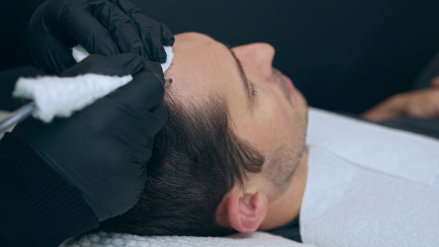 Dandruff Treatment for Men