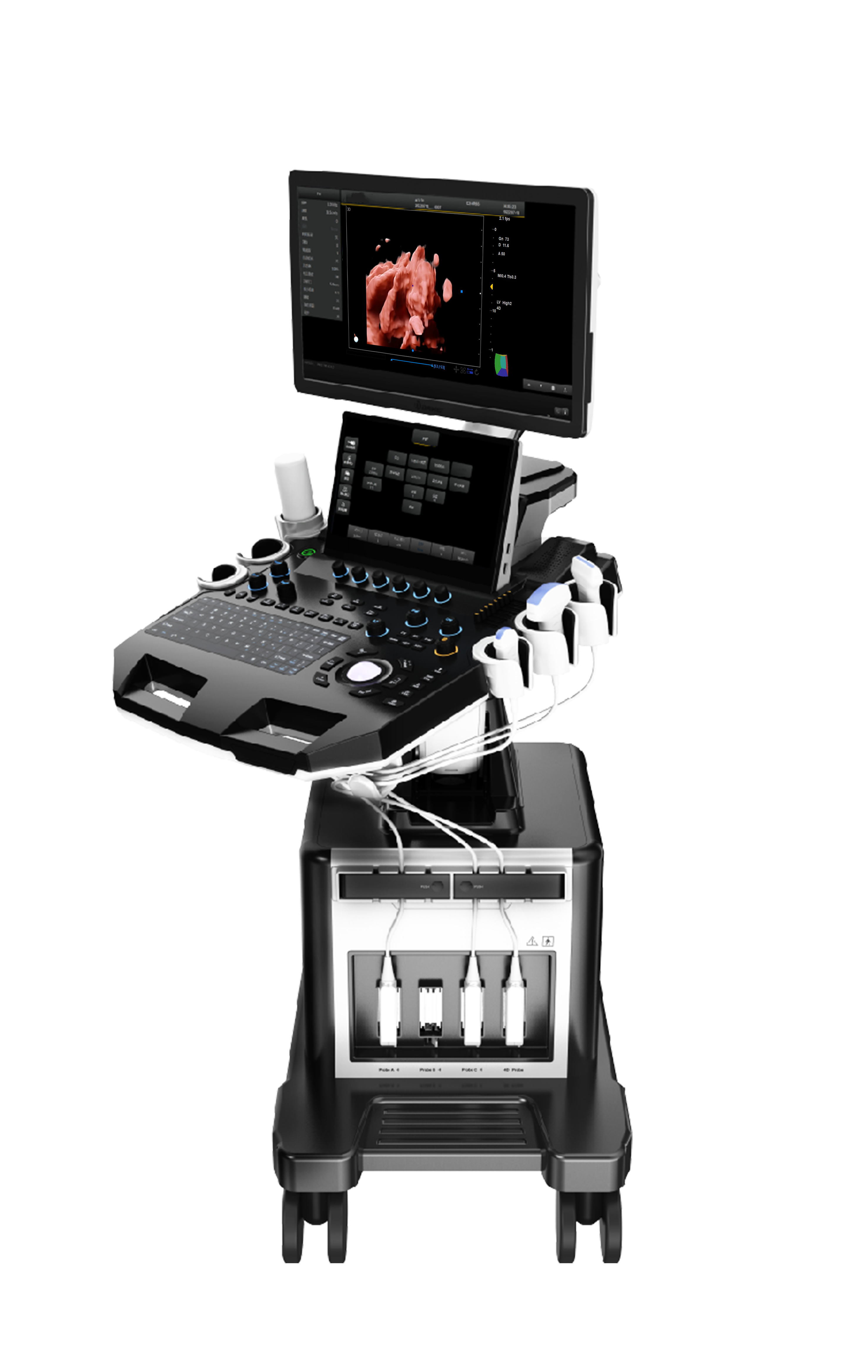 Color Doppler Ultrasound