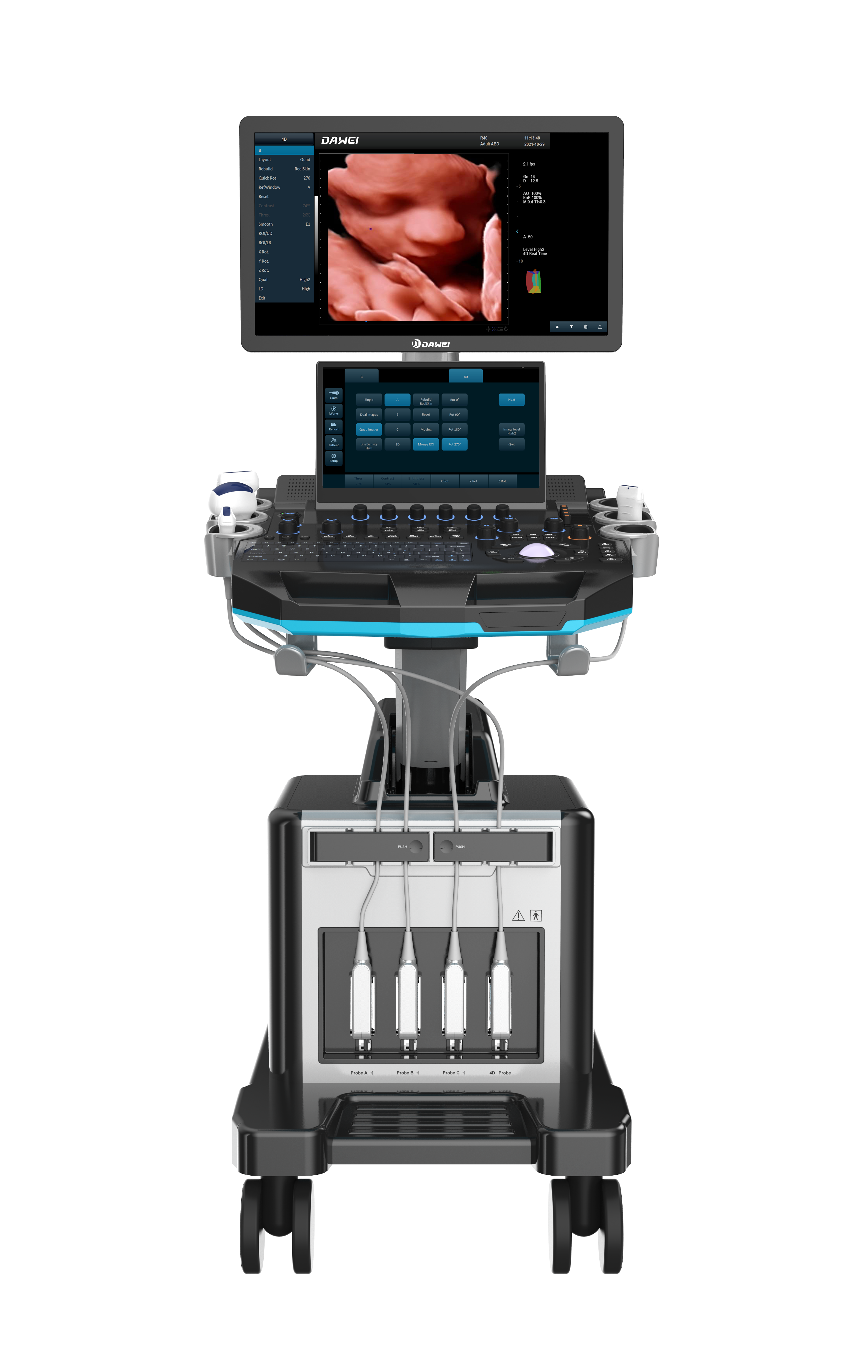 Color Doppler Ultrasound