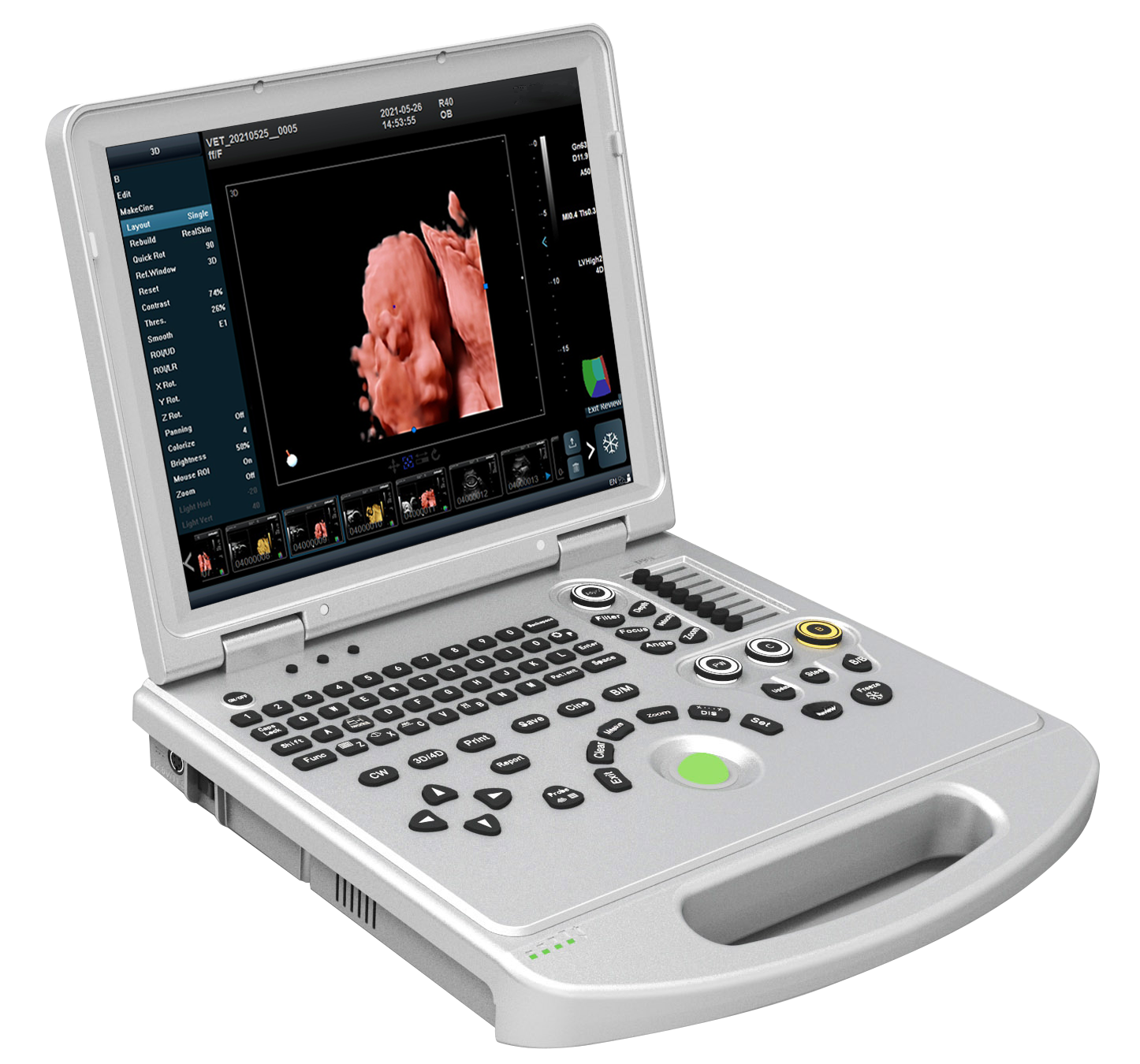Color Doppler Ultrasound