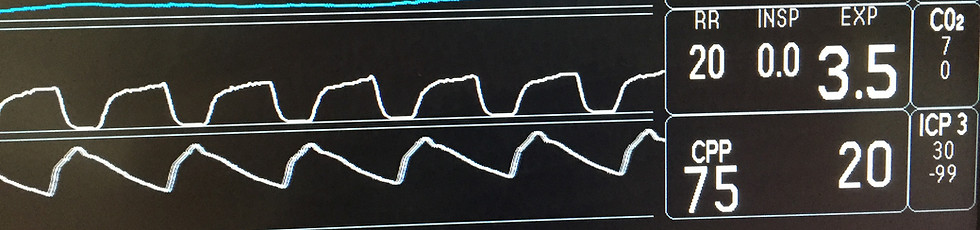 ICP waveform