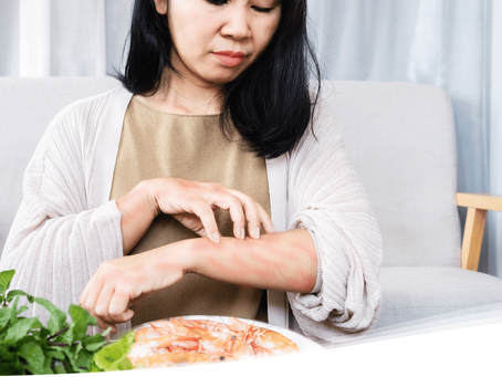 A woman sits at home scratching a red, irritated patch on her arm after eating prawns, showing an early sign of a food allergy. The image illustrates a real-world scenario used in FAB Training’s first aid courses on allergic reactions and anaphylaxis awareness.