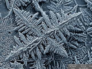 REM-Aufnahme einer Aluminium-Druckguss-Gefügestruktur mit ausgeprägten Dendritenarmen.