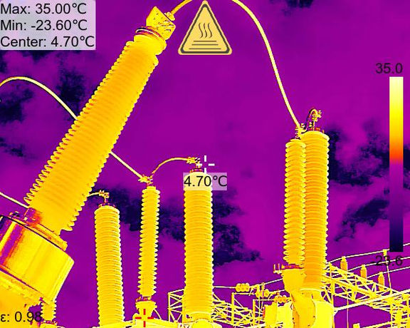 Hertzinno 超聲波成像儀實際應用 紅外線圖