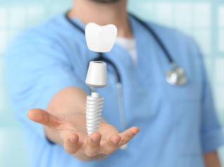 Implantes dentários em cerâmica ("biológicos") 