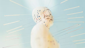 Acupuncture and Parkinson's Disease