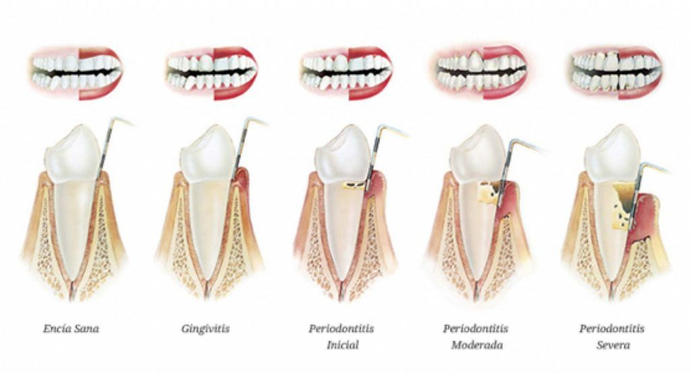 Periodoncia