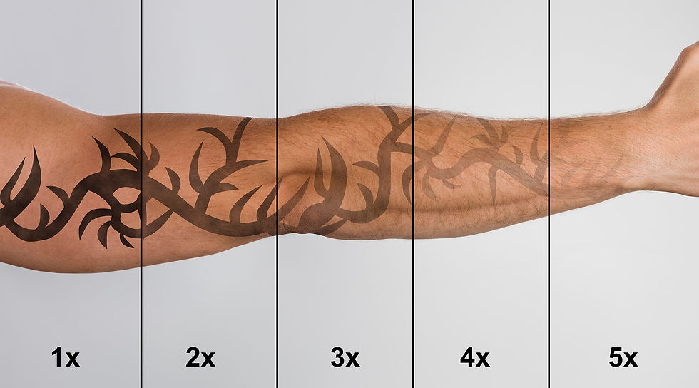 image d'un bras tatoué pouvant être traité par laser au centre laser montauban by la clinique boyé