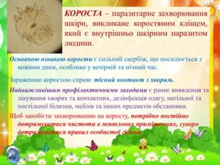 -14-320.webp