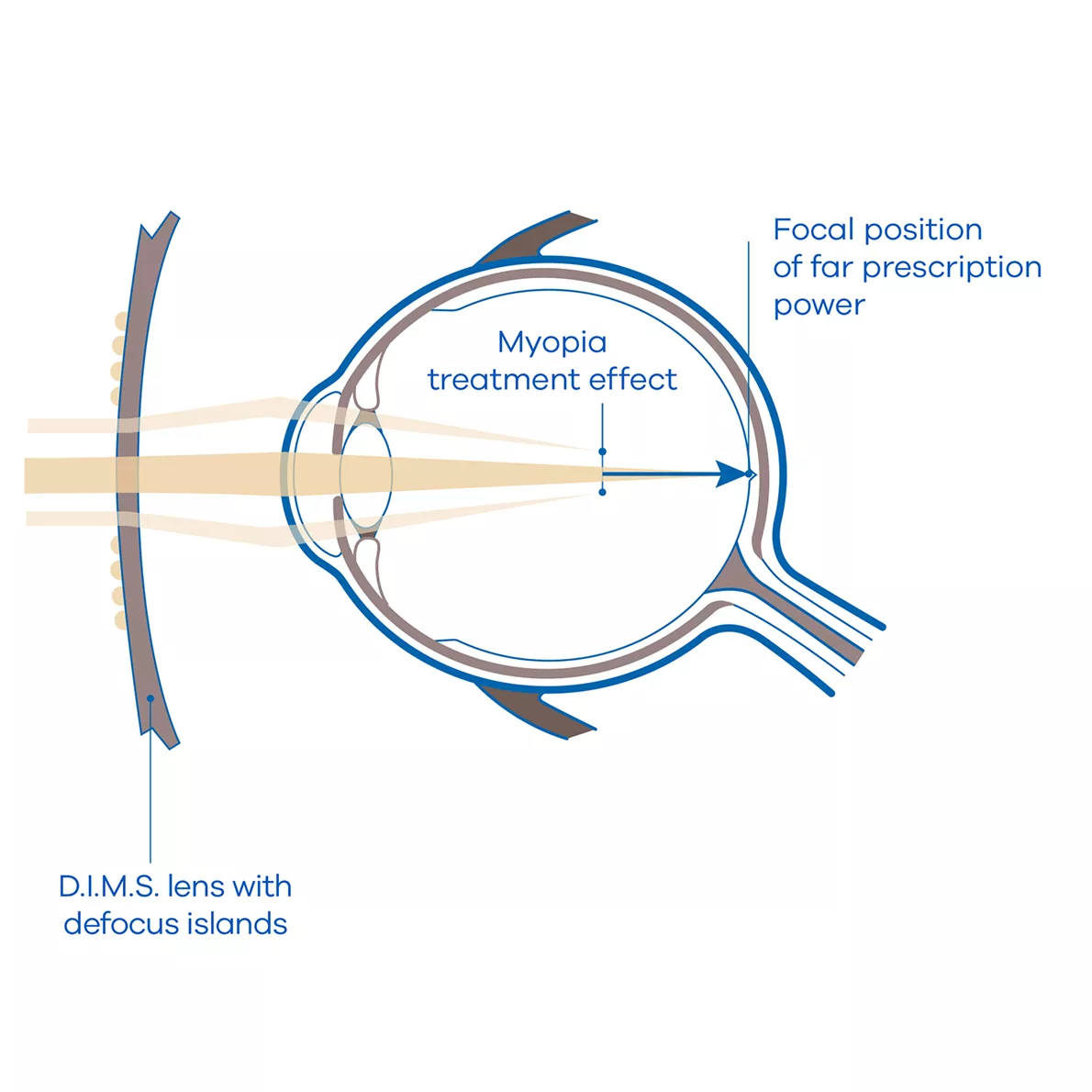 Proview Optical - HOYA Miyosmart Myopia Control Lenses