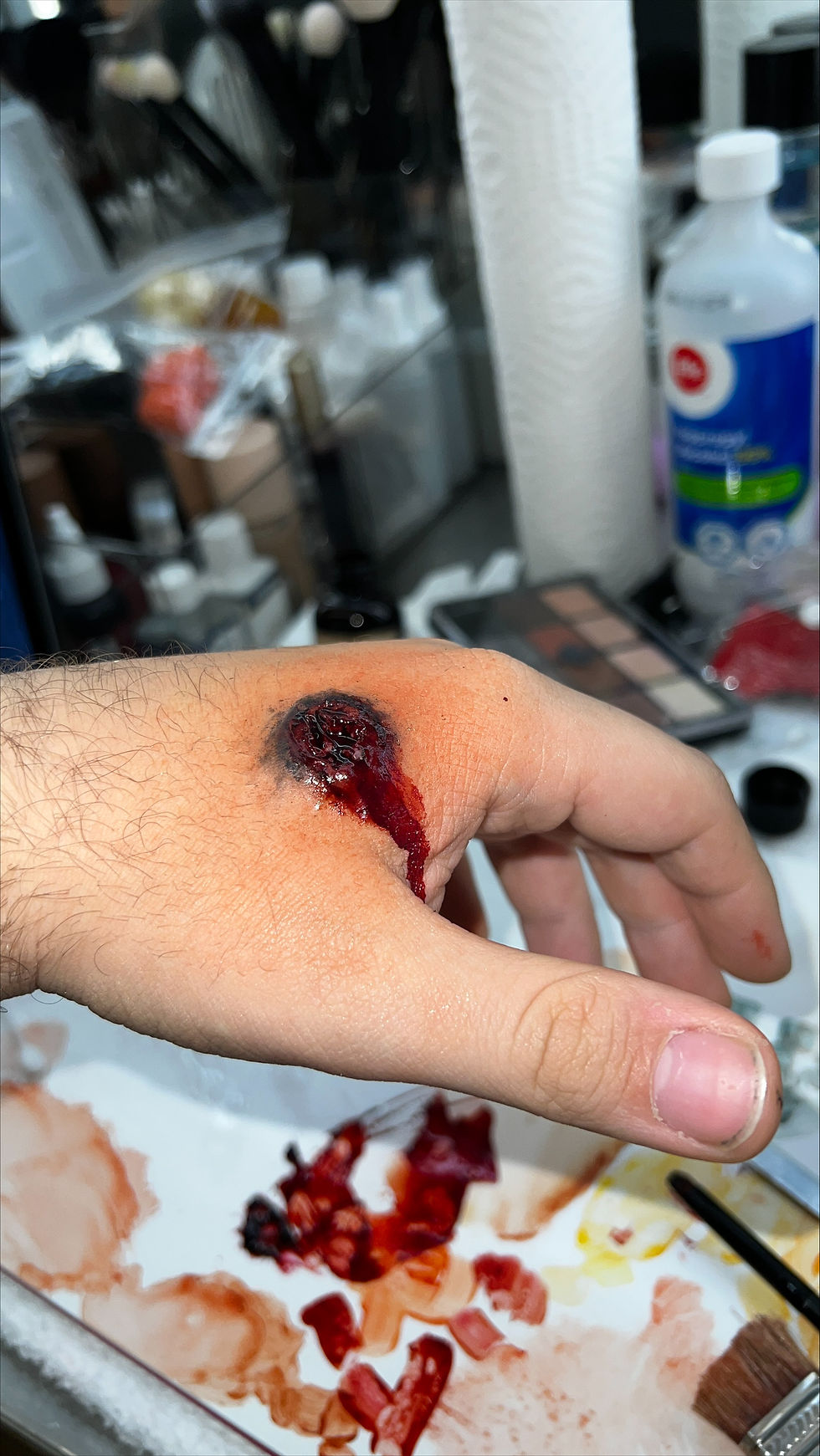 Entry Bullet Wound
