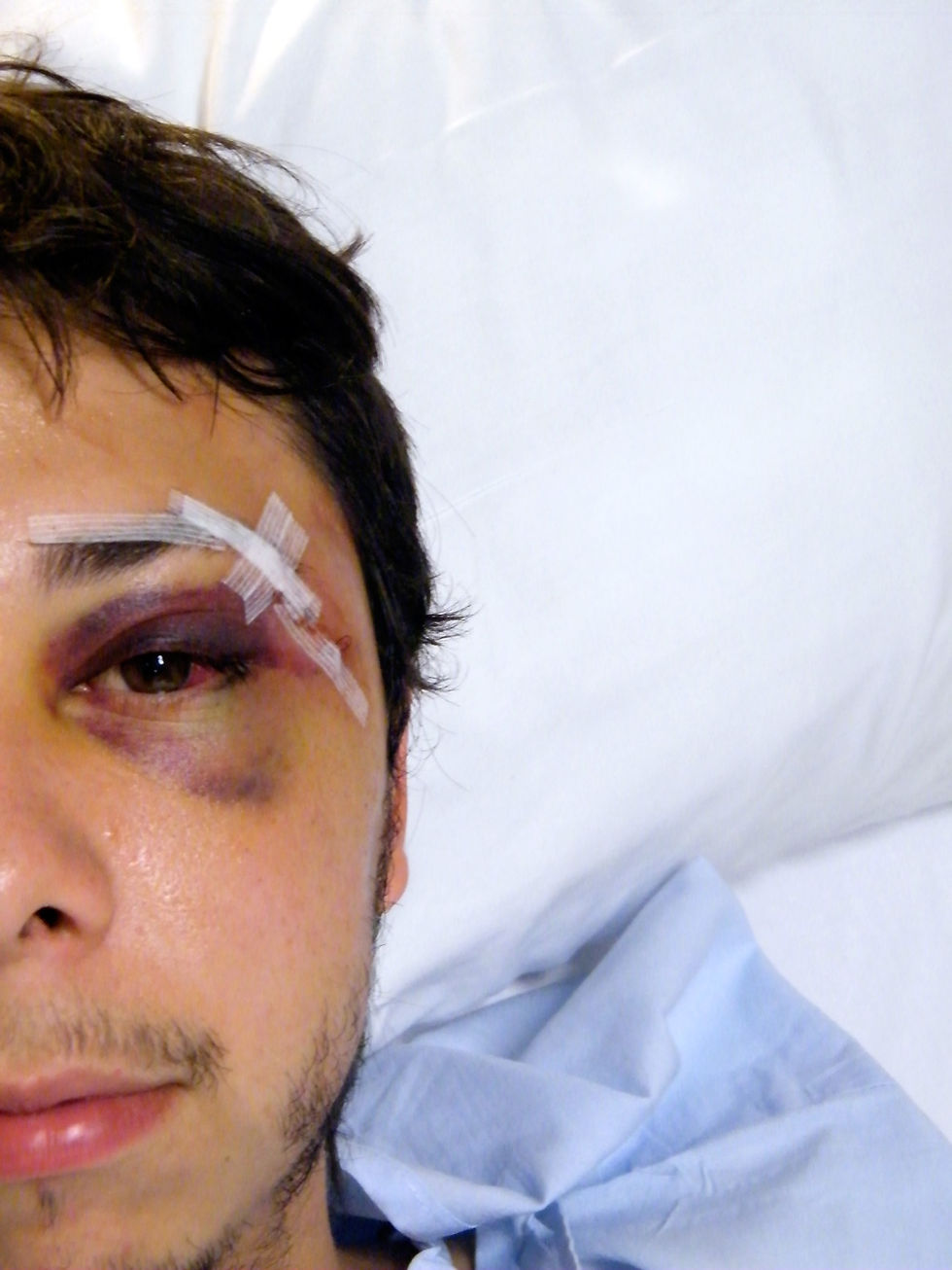 Accidente