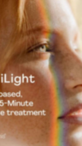 Optilight-Window1-500x500.jpeg