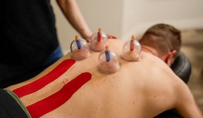 myofasccial decompression, cupping, one-on-one hands on physical therapy, manual therapy
