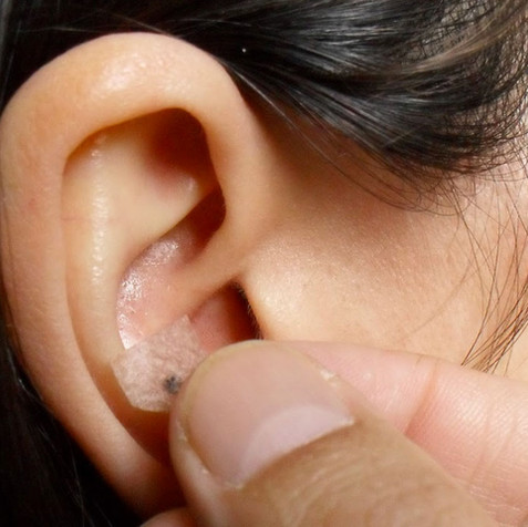 auriculoterapia-1.jpg