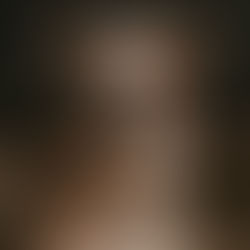 Happy dog? A brown and white dog with alert ears wears a collar, looking directly at the camera with a serious expression. Dark, blurred background.