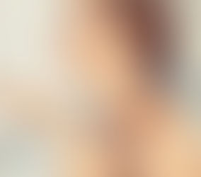 Ensor Cell PDRN:韩国制造婴儿针,细胞级焕肤,重塑年轻肌!