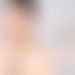 PDRNスキンヒーリングトリートメント：安全性と効果の分析