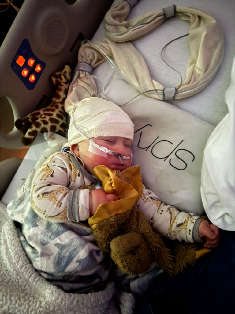 sleep study - CHECK. 