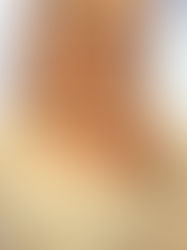 Patricia Skinmaster presentando depilación láser definitiva sin gel en Novopiel