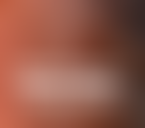 Return OF Capital vs. Return ON Capital: What Every Real Estate Investor Needs to Know