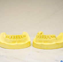 자가 치아미백에 필요한 트레이를 만들기 위한 치아 틀