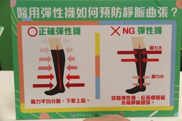 你知道你有須要壓力襪嗎?