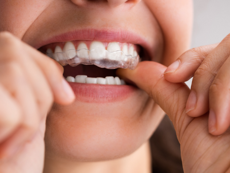 BRUXISMO: VOCÊ SABE O QUE É?