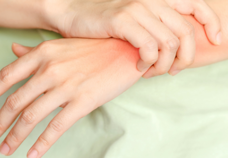 DESCUBRA COMO A OSTEOPOROSE PODE ESTAR LIGADA À DOR DE DENTE