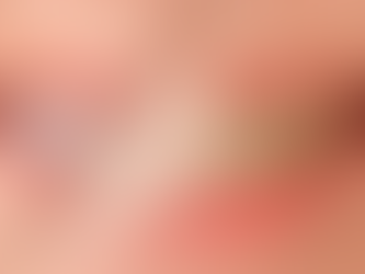 TÁRTARO: 3 DICAS PARA EVITÁ-LO