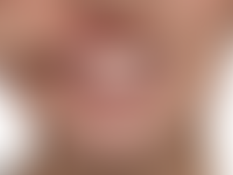 GENGIVITE PODE CAUSAR DOR DE DENTE?