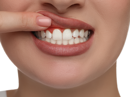 GENGIVITE PODE CAUSAR DOR DE DENTE?