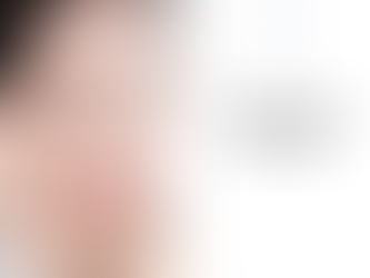 처진 피부 탄력 개선을 도와주 온다리프팅 