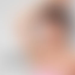 얼굴부터 겨드랑이 털 고민은 이제 그만