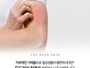 지속적인 가려움 참지 말고 적절한 두드러기 치료받아보세요