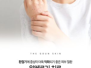 갈수록 악화되는 알레르기, 치료 방법을 찾고있다면?