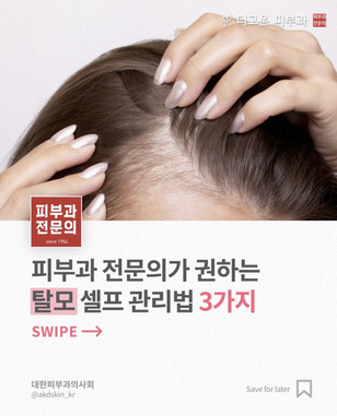 탈모 예방과 완화를 위한 관리방법 알려드립니다!