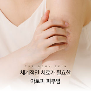 아토피, 체계적인 치료가 필요합니다.