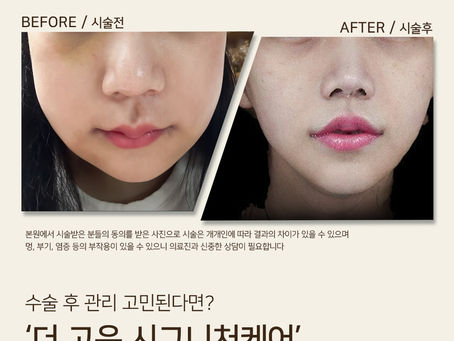 더고운피부과의 시그니처 관리!