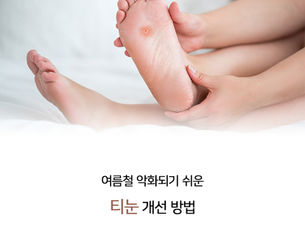 여름철 악화되기 쉬운 티눈 개선 방법은?