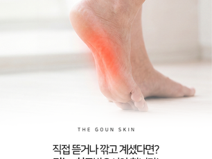 티눈은 직접 제거하려는 과정에서 더욱 깊어지게 될 수 있습니다.
