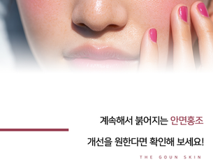 붉어지는 안면홍조 개선 방법은?