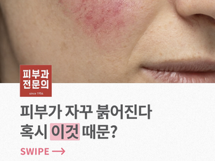 자꾸 붉어지는 피부, 그 이유는?