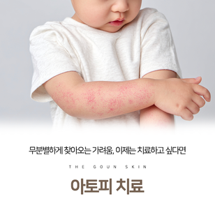 동래아토피피부과, 삶의 질을 떨어뜨리는 아토피 치료를 도와드립니다!