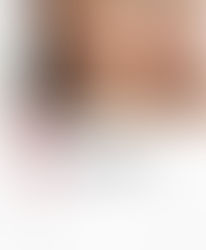 자꾸만 붉어지는 피부, 약해진 피부 장벽이 원인일 수 있습니다.